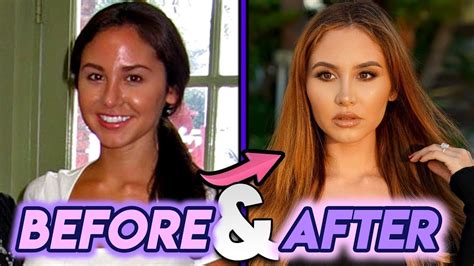 catherine paiz nose job|I wish Catherine Mcbroom/Paiz would just tell us who did her。